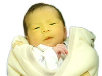 Neonatal jaundice